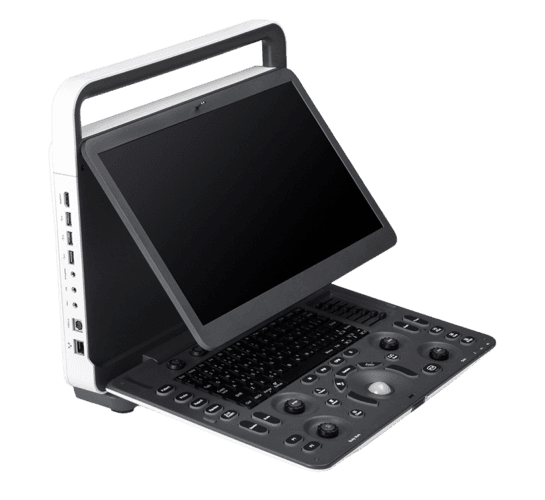 SonoScape E3 – Color Doppler Portátil de Alta Qualidade | Equipamentos médicos hospitalares em Brasília