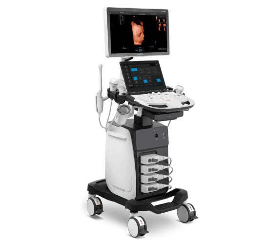 SonoScape P11 Elite – Compacto, Confiável e Pronto para o Dia a Dia | Equipamentos médicos hospitalares em Brasília