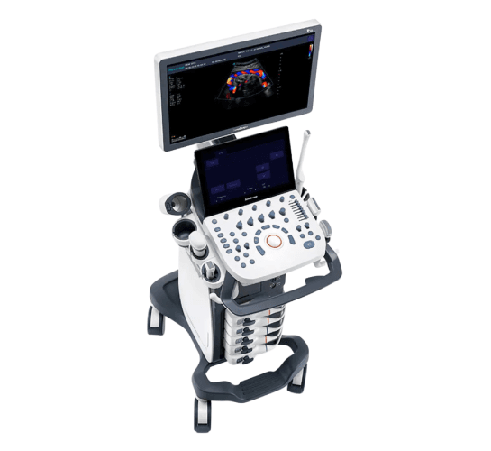 SonoScape P15 – Ultrassom Equilibrado para Rotina Clínica | Equipamentos médicos hospitalares em Brasília