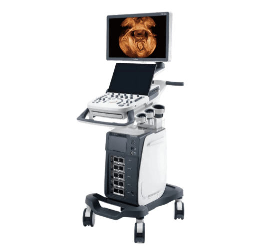 SonoScape P20 Elite – Eficiência e Qualidade de Imagem ao Seu Alcance | Equipamentos médicos hospitalares em Brasília