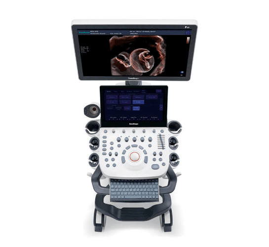 SonoScape P20 – Ultrassom Essencial com Performance Confiável | Equipamentos médicos hospitalares em Brasília