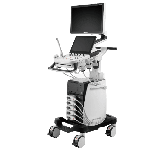 SonoScape P25 Elite – Ultrassom Compacto e Confiável para Diagnósticos Preciso | Equipamentos médicos hospitalares em Brasília