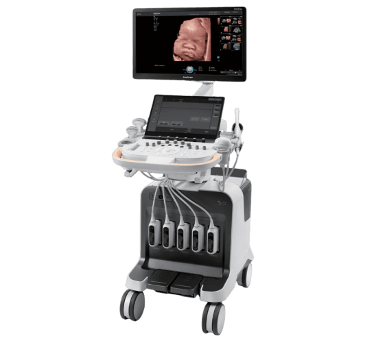 SonoScape P80 Elite – Trolley Color Doppler de Alta Performance | Equipamentos médicos hospitalares em Brasília