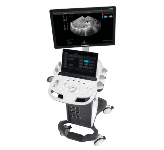 SonoScape P9 Elite – Confiabilidade Compacta para Exames Essenciais | Equipamentos médicos hospitalares em Brasília