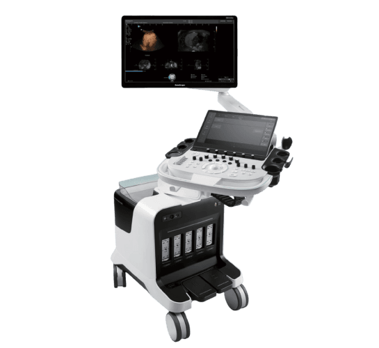 SonoScape S80 Elite – Ultrassom de Alta Tecnologia para Diagnóstico Confiável | Equipamentos médicos hospitalares em Brasília