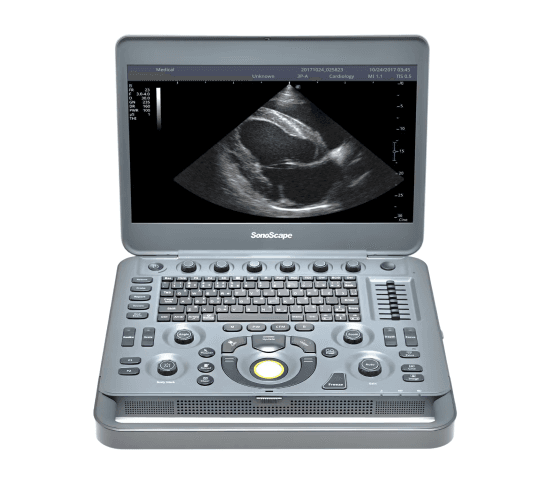 SonoScape X1 – Color Doppler Portátil de Alta Performance | Equipamentos médicos hospitalares em Brasília