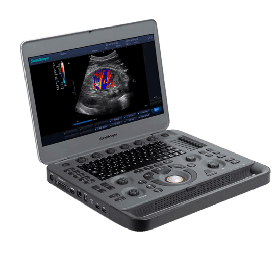 SonoScape X3 – Color Doppler Portátil e Inteligente | Equipamentos médicos hospitalares em Brasília